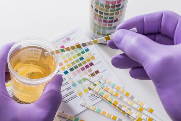 Urine Test Strip